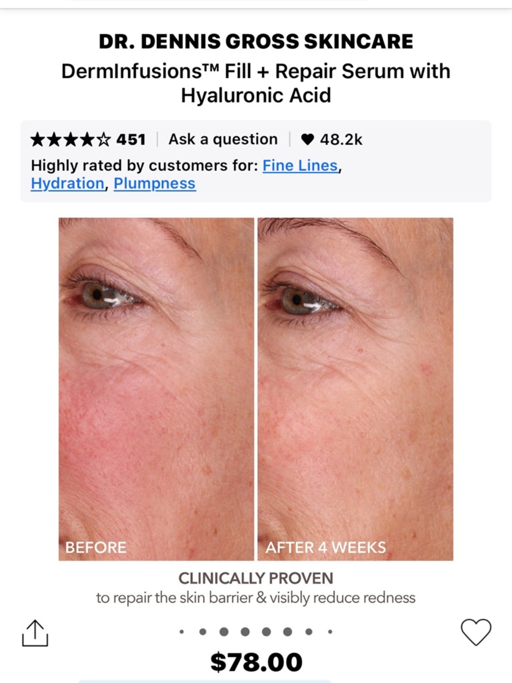 Dr. Dennis Gross Gold Hydrating Fill + Repair Serum - Picture 7 of 10